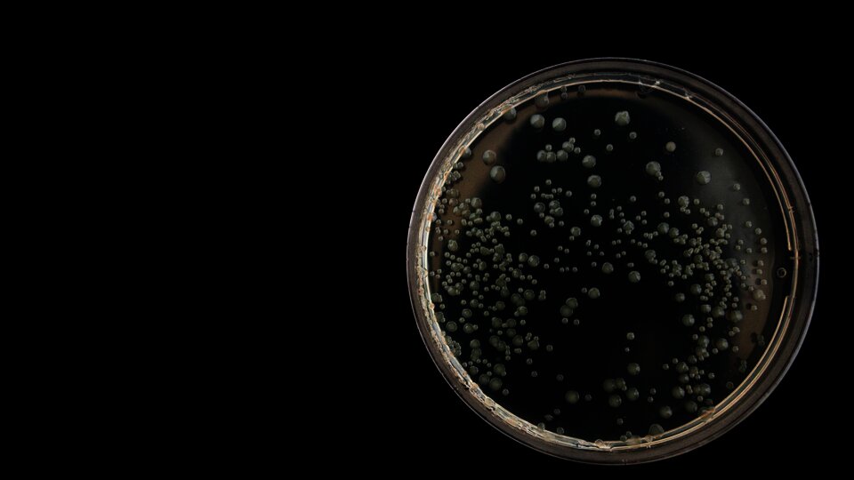 Bakterienkolonien in einer Petrischale | Pixabay